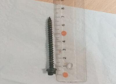 خارج کردن پیچ 7 سانتی از معده کودک