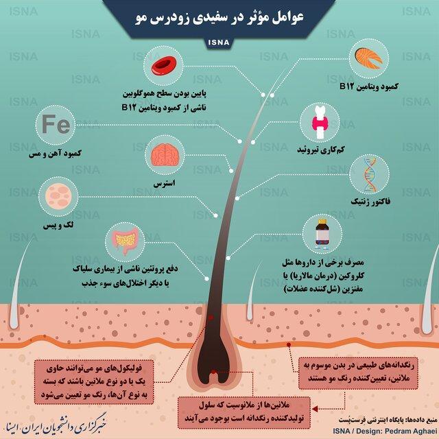 عوامل مؤثر در سفیدی زودرس مو اینفوگرافی عوامل مؤثر در سفیدی زودرس مو